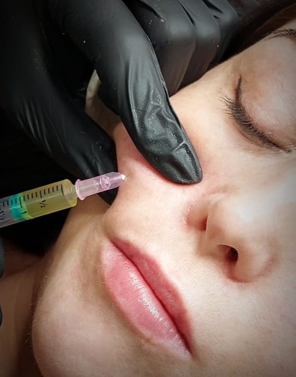 Mesotherapy